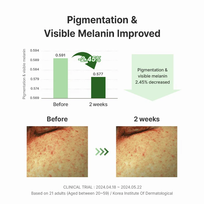 Gentle Vitamin C Serum - Image 7